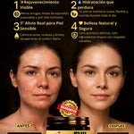 Evil Goods® - ¡¡Reduce arrugas. Elimina acné. Mejora tu piel!!